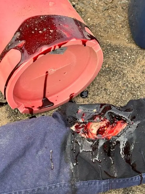 Casualty simulation detail used to test first aid response